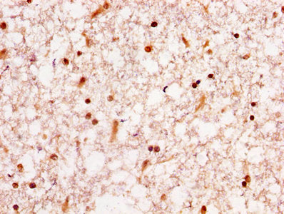 IHC image of HNRNPA1 Antibody diluted at 1:300 and staining in paraffin-embedded human brain tissue performed on a Leica BondTM system. After dewaxing and hydration, antigen retrieval was mediated by high pressure in a citrate buffer (pH 6.0). Section was blocked with 10% normal goat serum 30min at RT. Then primary antibody (1% BSA) was incubated at 4°C overnight. The primary is detected by a biotinylated secondary antibody and visualized using an HRP conjugated SP system.Rabbit anti-Human HNRNPA1 Polyclonal Antibody