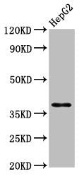 Western Blot  | Positive WB detected in: HepG2 whole cell lysate  | All lanes: HNRNPA1 antibody at 3.9µg/ml  | Secondary  | Goat polyclonal to rabbit IgG at 1/50000 dilution  | Predicted band size: 39, 35, 30 kDa  | Observed band size: 39 kDaRabbit anti-Human HNRNPA1 Polyclonal Antibody