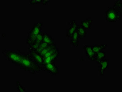 Immunofluorescent analysis of Hela cells using HNRNPA2B1 Antibody at dilution of 1:100 and Alexa Fluor 488-congugated AffiniPure Goat Anti-Rabbit IgG(H+L)Rabbit anti-Human HNRNPA2B1 Polyclonal Antibody
