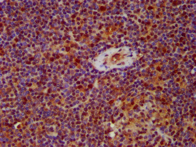 IHC image of HNRNPAB Antibody diluted at 1:500 and staining in paraffin-embedded human lymph node tissue performed on a Leica BondTM system. After dewaxing and hydration, antigen retrieval was mediated by high pressure in a citrate buffer (pH 6.0). Section was blocked with 10% normal goat serum 30min at RT. Then primary antibody (1% BSA) was incubated at 4°C overnight. The primary is detected by a biotinylated secondary antibody and visualized using an HRP conjugated SP system.Rabbit anti-Human HNRNPAB Polyclonal Antibody