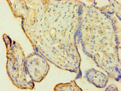 Immunohistochemistry of paraffin-embedded human placenta tissue using HNRNPH1 Antibody at dilution of 1:100Rabbit anti-Human HNRNPH1 Polyclonal Antibody
