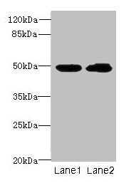 Western blot  | All lanes: HNRNPH1 antibody at 8µg/ml  | Lane 1: HepG2 whole cell lysate  | Lane 2: MCF-7 whole cell lysate  | Secondary  | Goat polyclonal to rabbit IgG at 1/10000 dilution  | Predicted band size: 50 kDa  | Observed band size: 50 kDaRabbit anti-Human HNRNPH1 Polyclonal Antibody