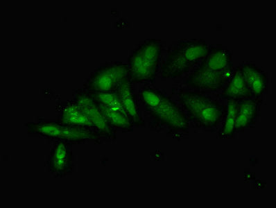 Immunofluorescent analysis of Hela cells using HNRNPL Antibody at dilution of 1:100 and Alexa Fluor 488-congugated AffiniPure Goat Anti-Rabbit IgG(H+L)Rabbit anti-Human HNRNPL Polyclonal Antibody