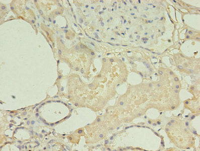 Immunohistochemistry of paraffin-embedded human kidney tissue using the antibody at dilution of 1:100Rabbit anti-Human HNRNPL Polyclonal Antibody