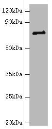 Western blot | All lanes: HNRNPM antibody at 2μg/ml + NIH/3T3 whole cell lysate | Secondary | Goat polyclonal to rabbit IgG at 1/10000 dilution | Predicted band size: 78, 74 kDa | Observed band size: 78 kDaRabbit anti-Human HNRNPM Polyclonal Antibody