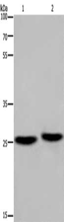 Gel: 8%SDS-PAGE, Lysate: 40 μg, Lane 1-2: Mouse brain tissue, human fetal muscle tissue, Primary antibody: EPDR1 Antibody(EPDR1 Antibody) at dilution 1/850, Secondary antibody: Goat anti rabbit IgG at 1/8000 dilution, Exposure time: 20 secondsRabbit anti-Human EPDR1 Polyclonal Antibody