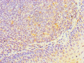 Immunohistochemistry of paraffin-embedded human tonsil tissue using HOXA1 Antibody at dilution of 1:100Rabbit anti-Human HOXA1 Polyclonal Antibody