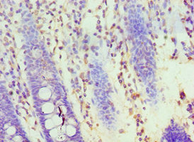 Immunohistochemistry of paraffin-embedded human colon tissue using HOXA1 Antibody at dilution of 1:100Rabbit anti-Human HOXA1 Polyclonal Antibody