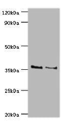 Western blot | All lanes: HOXA1 antibody at 2μg/ml | Lane 1: NIH/3T3 whole cell lysate | Lane 2: Hela whole cell lysate | Secondary | Goat polyclonal to rabbit IgG at 1/10000 dilution | Predicted band size: 37, 15, 25 kDa | Observed band size: 37 kDaRabbit anti-Human HOXA1 Polyclonal Antibody