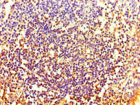 Immunohistochemistry of paraffin-embedded human tonsil tissue using HOXA2 Antibody at dilution of 1:100Rabbit anti-Human HOXA2 Polyclonal Antibody