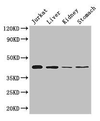 Western Blot | Positive WB detected in: Jurkat whole cell lysate, Mouse liver tissue, Mouse kidney tissue, Mouse stomach tissue | All lanes: Hoxa2 antibody at 2μg/ml | Secondary | Goat polyclonal to rabbit IgG at 1/50000 dilution | Predicted band size: 42 kDa | Observed band size: 42 kDaRabbit anti-Human HOXA2 Polyclonal Antibody