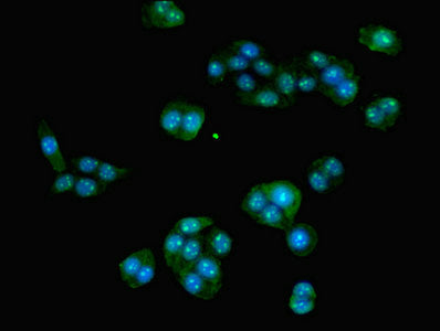 Immunofluorescent analysis of PC-3 cells using HOXA9 Antibody at dilution of 1:100 and Alexa Fluor 488-congugated AffiniPure Goat Anti-Rabbit IgG(H+L)Rabbit anti-Human HOXA9 Polyclonal Antibody