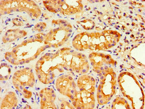 Immunohistochemistry of paraffin-embedded human kidney tissue using the antibody at dilution of 1:100Rabbit anti-Human HOXA9 Polyclonal Antibody