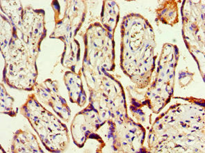 Immunohistochemistry of paraffin-embedded human placenta tissue using HOXA9 Antibody at dilution of 1:100Rabbit anti-Human HOXA9 Polyclonal Antibody