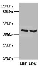 Western blot | All lanes: HOXD10 antibody at 3.21μg/ml | Lane 1: Mouse liver tissue | Lane 2: Mouse gonadal tissue | Secondary | Goat polyclonal to rabbit IgG at 1/10000 dilution | Predicted band size: 38 kDa | Observed band size: 38 kDaRabbit anti-Human HOXD10 Polyclonal Antibody