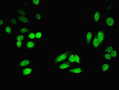 Immunofluorescent analysis of HepG2 cells using HPD Antibody at dilution of 1:100 and Alexa Fluor 488-congugated AffiniPure Goat Anti-Rabbit IgG(H+L)Rabbit anti-Human HPD Polyclonal Antibody