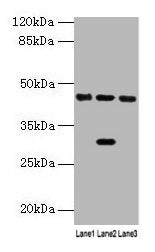 Western blot  | All lanes: HPD antibody at 4.5µg/ml  | Lane 1: Mouse kidney tissue  | Lane 2: Mouse liver tissue  | Lane 3: HepG2 whole cell lysate  | Secondary  | Goat polyclonal to rabbit IgG at 1/10000 dilution  | Predicted band size: 45, 41 kDa  | Observed band size: 45 kDaRabbit anti-Human HPD Polyclonal Antibody
