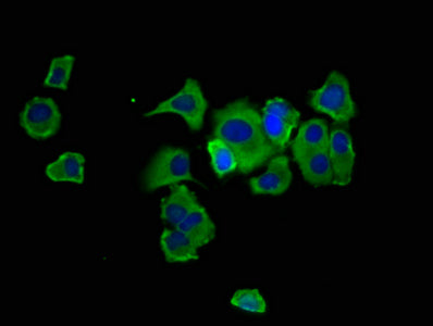 Immunofluorescence staining of MCF-7 cells with HPN Antibody at 1:133, counter-stained with DAPI. The cells were fixed in 4% formaldehyde, permeabilized using 0.2% Triton X-100 and blocked in 10% normal Goat Serum. The cells were then incubated with the antibody overnight at 4°C. The secondary antibody was Alexa Fluor 488-congugated AffiniPure Goat Anti-Rabbit IgG(H+L).Rabbit anti-Human HPN Polyclonal Antibody
