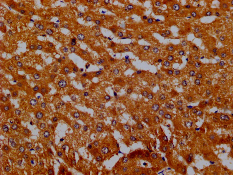 Immunohistochemistry of paraffin-embedded Human live tissue using Hpx Antibody at dilution of 1:200Rabbit anti-Rattus norvegicus (Rat) Hpx Polyclonal Antibody