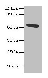 Western blotAll lanes: Hpx antibody at 4.5µg/ml + HepG2 whole cell lysateSecondaryGoat polyclonal to rabbit IgG at 1/10000 dilutionPredicted band size: 52 kDaObserved band size: 52 kDaRabbit anti-Rattus norvegicus (Rat) Hpx Polyclonal Antibody