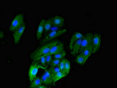 Immunofluorescent analysis of HepG2 cells using HRH1 Antibody at dilution of 1:100 and Alexa Fluor 488-congugated AffiniPure Goat Anti-Rabbit IgG(H+L)Rabbit anti-Human HRH1 Polyclonal Antibody