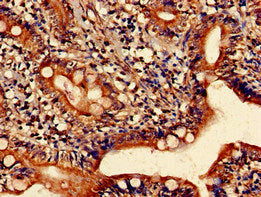 Immunohistochemistry of paraffin-embedded human small intestine tissue using the antibody at dilution of 1:100Rabbit anti-Human HRH1 Polyclonal Antibody