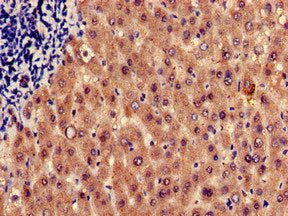 Immunohistochemistry of paraffin-embedded human liver tissue using HRH1 Antibody at dilution of 1:100Rabbit anti-Human HRH1 Polyclonal Antibody