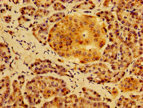 Immunohistochemistry of paraffin-embedded human pancreatic tissue using HS2ST1 Antibody at dilution of 1:100Rabbit anti-Human HS2ST1 Polyclonal Antibody