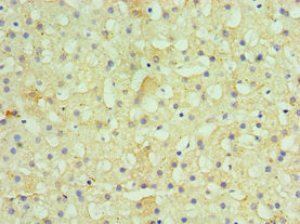Immunohistochemistry of paraffin-embedded human liver tissue using HSD11B1 Antibody at dilution of 1:100Rabbit anti-Human HSD11B1 Polyclonal Antibody