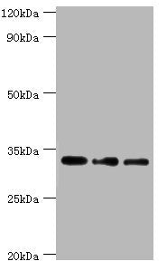 Western blot | All lanes: Corticosteroid 11-beta-dehydrogenase isozyme 1 antibody at 7μg/ml | Lane 1: Mouse liver tissue | Lane 2: Jurkat whole cell lysate | Lane 3: LO2 whole cell lysate | Secondary | Goat polyclonal to rabbit IgG at 1/10000 dilution | Predicted band size: 32 kDa | Observed band size: 32 kDaRabbit anti-Human HSD11B1 Polyclonal Antibody