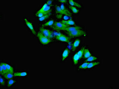 Immunofluorescent analysis of Hela cells using HSD11B1 Antibody at dilution of 1:100 and Alexa Fluor 488-congugated AffiniPure Goat Anti-Rabbit IgG(H+L)Rabbit anti-Human HSD11B1 Polyclonal Antibody