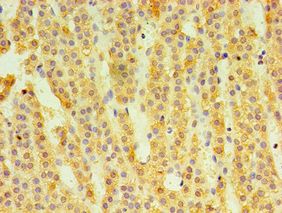 Immunohistochemistry of paraffin-embedded human adrenal gland tissue using HSD11B1 Antibody at dilution of 1:100Rabbit anti-Human HSD11B1 Polyclonal Antibody