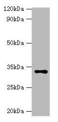 Western blot  | All lanes: HSD11B1 antibody at 2µg/ml + Hela whole cell lysate  | Secondary  | Goat polyclonal to rabbit IgG at 1/10000 dilution  | Predicted band size: 33 kDa  | Observed band size: 33 kDaRabbit anti-Human HSD11B1 Polyclonal Antibody