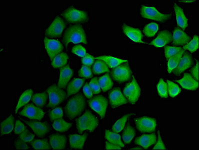 Immunofluorescence staining of Hela cells with HSD17B1 Antibody at 1:33, counter-stained with DAPI. The cells were fixed in 4% formaldehyde, permeabilized using 0.2% Triton X-100 and blocked in 10% normal Goat Serum. The cells were then incubated with the antibody overnight at 4°C. The secondary antibody was Alexa Fluor 488-congugated AffiniPure Goat Anti-Rabbit IgG(H+L).Rabbit anti-Human HSD17B1 Polyclonal Antibody