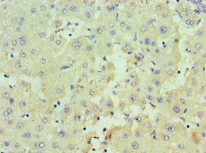 Immunohistochemistry of paraffin-embedded human liver tissue using HSD17B4 Antibody at dilution of 1:100