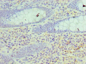 Immunohistochemistry of paraffin-embedded human epityphlon tissue using HSD17B4 Antibody at dilution of 1:100