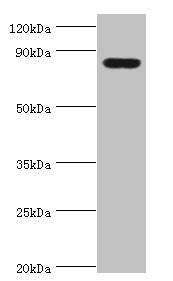 Western blot | All lanes: Peroxisomal multifunctional enzyme type 2 antibody at 3μg/ml + Mouse liver tissue | Secondary | Goat polyclonal to rabbit IgG at 1/10000 dilution | Predicted band size: 80, 84, 78 kDa | Observed band size: 80 kDa