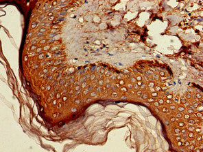 Immunohistochemistry of paraffin-embedded human skin tissue using HSD3B1 Antibody at dilution of 1:100Rabbit anti-Human HSD3B1 Polyclonal Antibody