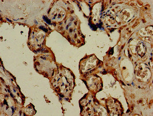 Immunohistochemistry of paraffin-embedded human placenta tissue using HSD3B1 Antibody at dilution of 1:100Rabbit anti-Human HSD3B1 Polyclonal Antibody