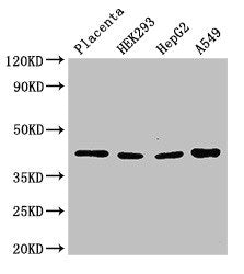 Western Blot  | Positive WB detected in: Human placenta tissue, HEK293 whole cell lysate, HepG2 whole cell lysate, A549 whole cell lysate  | All lanes: HSD3B1 antibody at 3µg/ml  | Secondary  | Goat polyclonal to rabbit IgG at 1/50000 dilution  | Predicted band size: 43 kDa  | Observed band size: 43 kDaRabbit anti-Human HSD3B1 Polyclonal Antibody