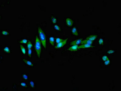 Immunofluorescent analysis of Hela cells using HSF1 Antibody at dilution of 1:100 and Alexa Fluor 488-congugated AffiniPure Goat Anti-Rabbit IgG(H+L)Rabbit anti-Human HSF1 Polyclonal Antibody