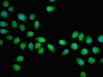 Immunofluorescent analysis of A549 cells using HSF2 Antibody at dilution of 1:100 and Alexa Fluor 488-congugated AffiniPure Goat Anti-Rabbit IgG(H+L)Rabbit anti-Human HSF2 Polyclonal Antibody