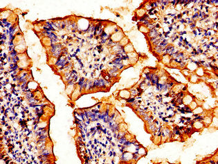 Immunohistochemistry of paraffin-embedded human small intestine tissue using HSF2 Antibody at dilution of 1:100Rabbit anti-Human HSF2 Polyclonal Antibody