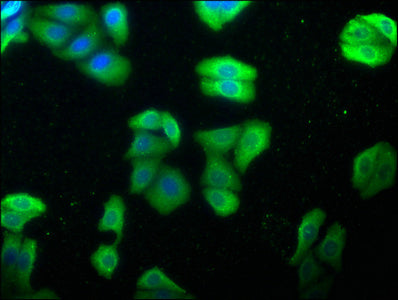 Immunofluorescence staining of HepG2 cells with HSPA1L Antibody at 1:100, counter-stained with DAPI. The cells were fixed in 4% formaldehyde, permeabilized using 0.2% Triton X-100 and blocked in 10% normal Goat Serum. The cells were then incubated with the antibody overnight at 4°C. The secondary antibody was Alexa Fluor 488-congugated AffiniPure Goat Anti-Rabbit IgG(H+L).Rabbit anti-Human HSPA1L Polyclonal Antibody