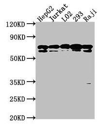 Western Blot | Positive WB detected in: HepG2 whole cell lysate, Jurkat whole cell lysate, L02 whole cell lysate, 293 whole cell lysate, Raji whole cell lysate | All lanes: HSPA1L antibody at 1:2000 | Secondary | Goat polyclonal to rabbit IgG at 1/50000 dilution | Predicted band size: 71 kDa | Observed band size: 71 kDaRabbit anti-Human HSPA1L Polyclonal Antibody