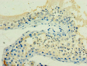 Immunohistochemistry of paraffin-embedded human testis tissue using HSPA2 Antibody at dilution of 1:100Rabbit anti-Human HSPA2 Polyclonal Antibody