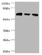 Western blot | All lanes: HSPA2 antibody at 6μg/ml | Lane 1: A431 whole cell lysate | Lane 2: Hela whole cell lysate | Lane 3: Rat brain tissue | Secondary | Goat polyclonal to rabbit IgG at 1/10000 dilution | Predicted band size: 70 kDa | Observed band size: 70 kDaRabbit anti-Human HSPA2 Polyclonal Antibody