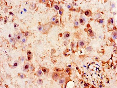 Immunohistochemistry of paraffin-embedded human placenta tissue using PITX3 Antibody at dilution of 1:100Rabbit anti-Human PITX3 Polyclonal Antibody