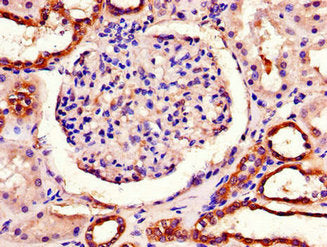 Immunohistochemistry of paraffin-embedded human kidney tissue using PITX3 Antibody at dilution of 1:100Rabbit anti-Human PITX3 Polyclonal Antibody