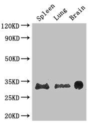 Western Blot | Positive WB detected in: Mouse spleen tissue, Mouse lung tissue, Mouse brain tissue | All lanes: PITX3 antibody at 2.7μg/ml | Secondary | Goat polyclonal to rabbit IgG at 1/50000 dilution | Predicted band size: 32 kDa | Observed band size: 32 kDaRabbit anti-Human PITX3 Polyclonal Antibody